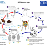 ស៊ីស្តូសូម៉ាមេគង្គី (Schistosomiasis Mekongi)